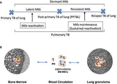 Initiation of Post-Primary Tuberculosis of the Lungs: Exploring the Secret Role of Bone Marrow Derived Stem Cells